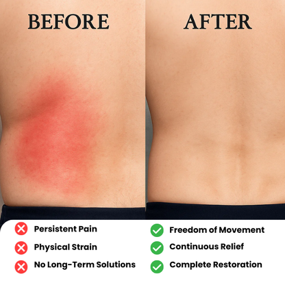 HerveraCure™ Natural Soothing Patches